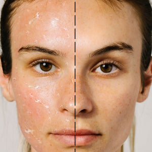 Bioactive Rose Gommage - Odacite Sweden